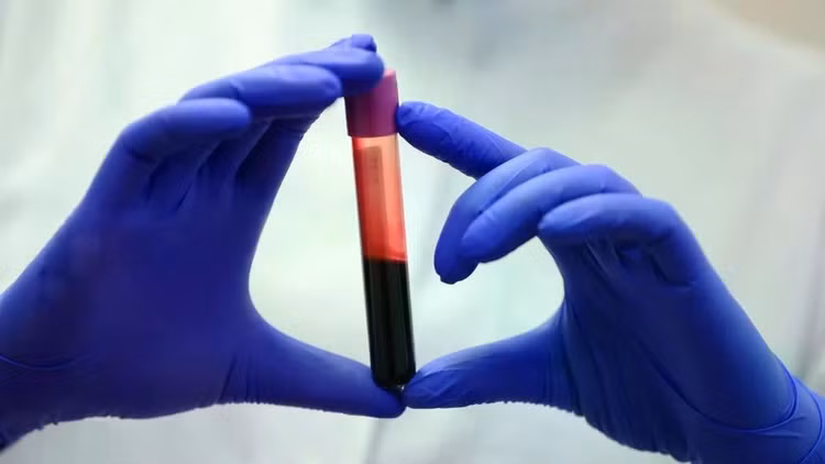bloodsamplejpg.jpg