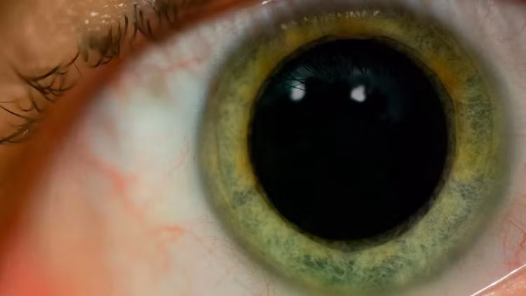 dilated-pupiljpg.jpg