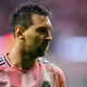 Messi bị chấn thương, Argentina lo lắng trước thềm World Cup