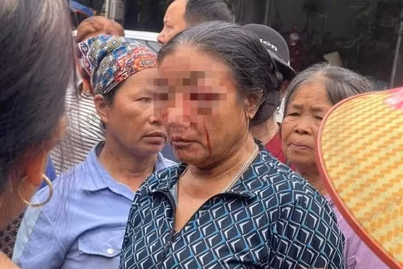 Giao công an xác minh thông tin người phụ nữ bán rau bị xịt nước chảy máu mặt