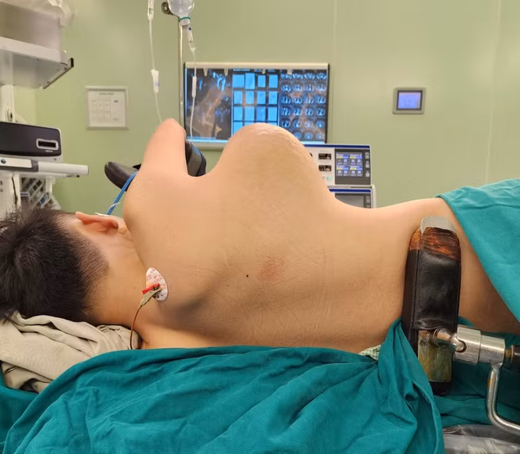 Khối u khủng 'dính' trên ngực bệnh nhân nhiều năm nay khiến cuộc sống và học tập của cậu bé MInh Tú bị ảnh hưởng rất nhiều. Ảnh: sức khỏe và đời sống.