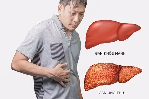 Ảnh minh họa - Ảnh: internet.