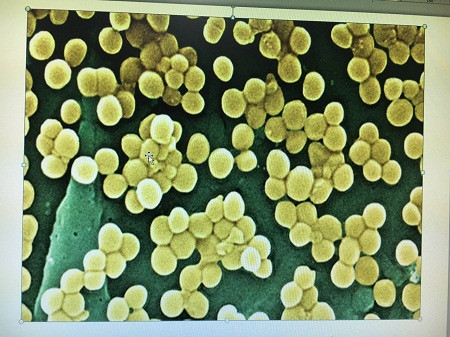 Hình thái của tụ cầu vàng. - Ảnh: internet.