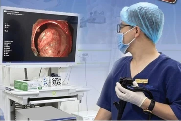 Đau bụng đi khám, nam bệnh nhân phát hiện u thần kinh nội tiết ở trực tràng
