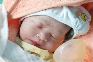 Cứu hai mẹ con thai phụ 35 tuần rau bong non nguy kịch