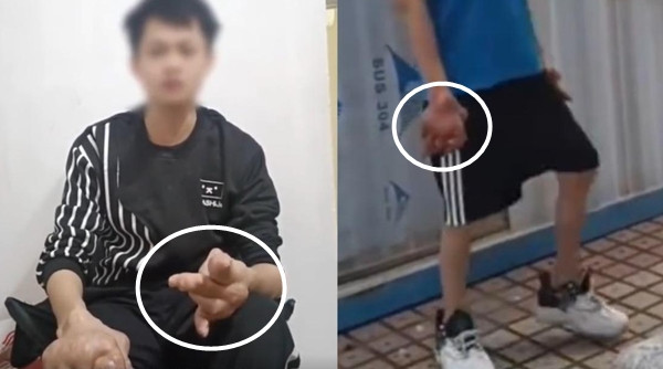 Anh Lam nghẹn ngào chia sẻ về căn bệnh gút mà mình mắc phải. (Ảnh: Red Star News)