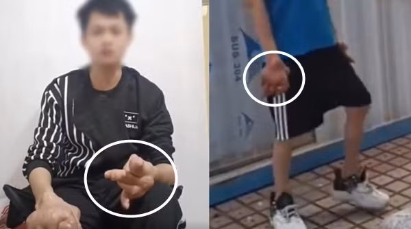 Anh Lam nghẹn ngào chia sẻ về căn bệnh gút mà mình mắc phải. (Ảnh: Red Star News)