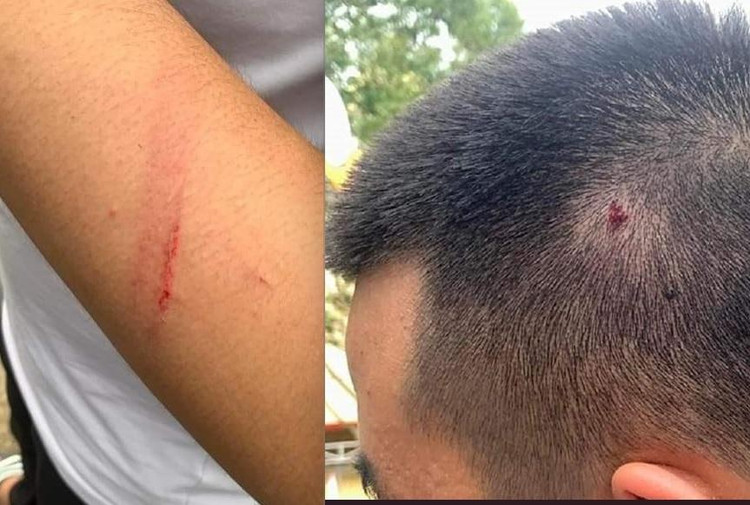 Vết thương trên tay và đầu học sinh bị đánh.