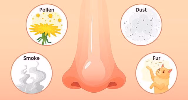 Tác nhân gây viêm mũi dị ứng ví dụ như bụi nhà, bụi môi trường, nấm mốc, phấn hoa… gây triệu chứng dị ứng từng đợt.