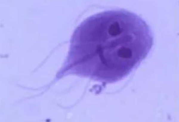 Hình ảnh ký sinh trùng Giardia lamblia được tìm thấy trong phân của anh Tiểu Chu.