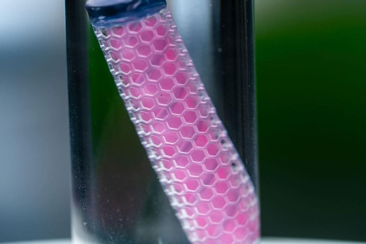 Bộ cấy sẽ vừa theo dõi tế bào ung thư vừa cung cấp thuốc điều trị - Ảnh: Đại học Rice. Bộ cấy sẽ vừa theo dõi tế bào ung thư vừa cung cấp thuốc điều trị - Ảnh: Đại học Rice.