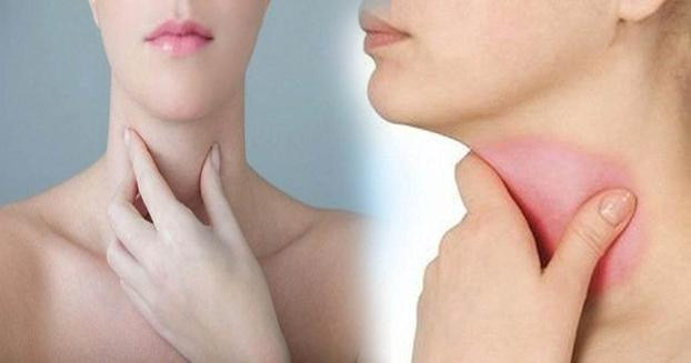 Khi thấy có dấu hiệu sưng, đau, khối u ở cổ nên đi khám ung thư tuyến giáp sớm. Ảnh minh họa