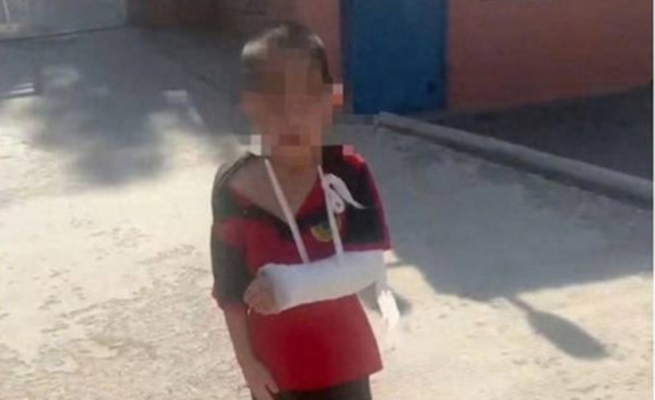 Bé trai gãy tay do bị huấn luyện viên 17 tuổi đánh đập nhưng nhà trường lại nói dối, thông báo em bị ngã.