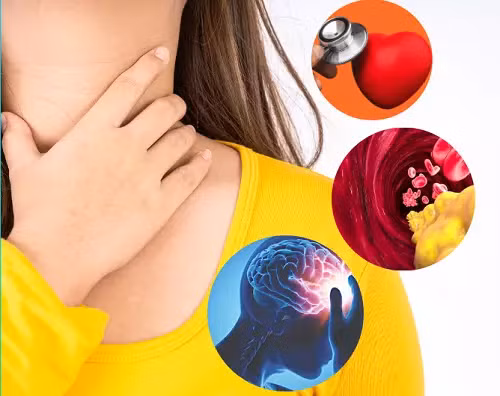 Người mắc suy giáp có nguy cơ bị suy tim, xơ vữa động mạch, đột quỵ