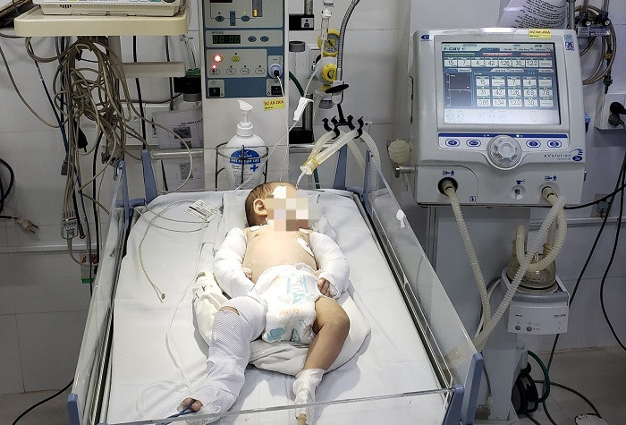 Bé gái đang được điều trị tích cực tại Bệnh viện đa khoa tỉnh Lâm Đồng. Ảnh VTC News