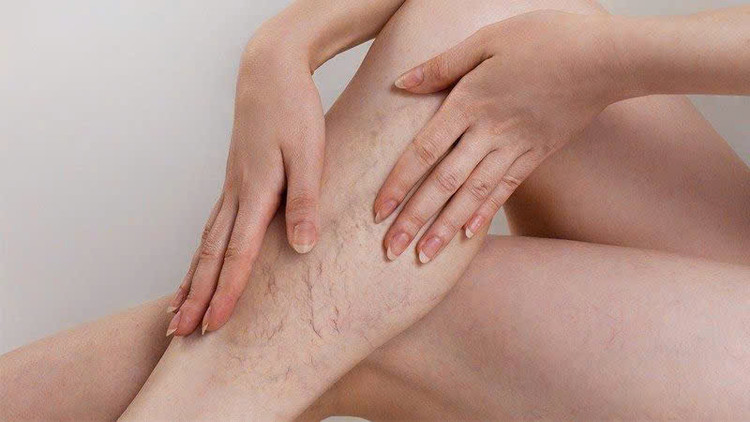 Hình minh hoạ/ Nguồn: Internet