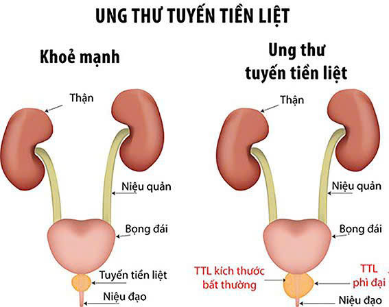 Hình minh hoạ/ Nguồn: Internet
