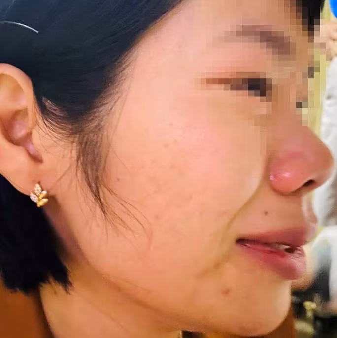 Cô Vũ Thị Kim Quy bị thầy giáo đánh gây thương tích.