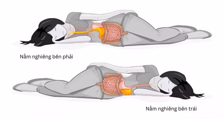 Ảnh minh họa Ảnh minh họa