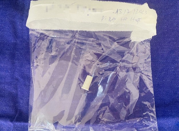 Dị vật là chiếc còi nhựa được gắp ra thành công. Ảnh Dantri