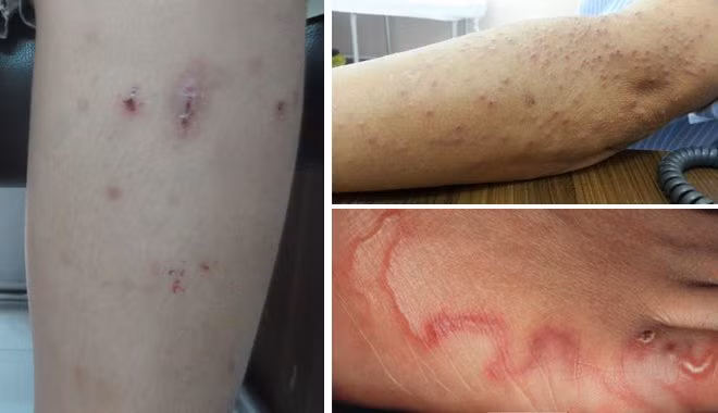 Ảnh minh hoạ Ảnh minh hoạ