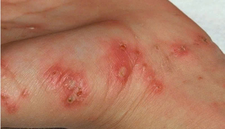 Ảnh minh họa Ảnh minh họa