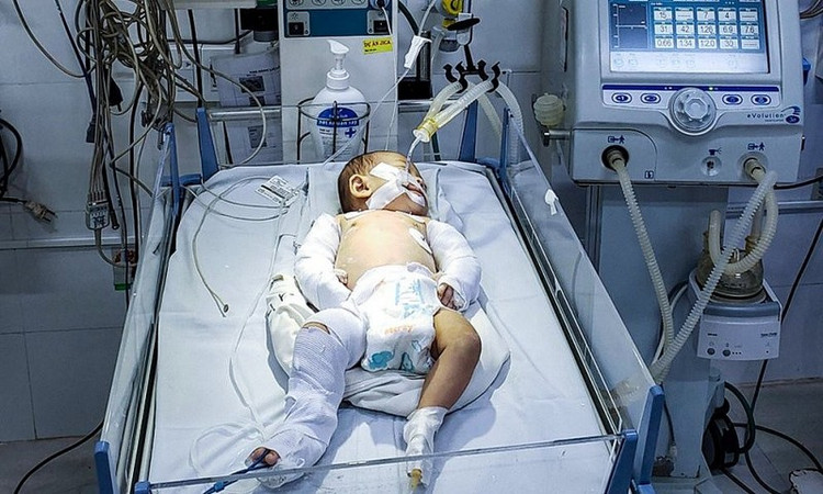 Bé gái đang được điều trị tại Bệnh viên Đa khoa Lâm Đồng.