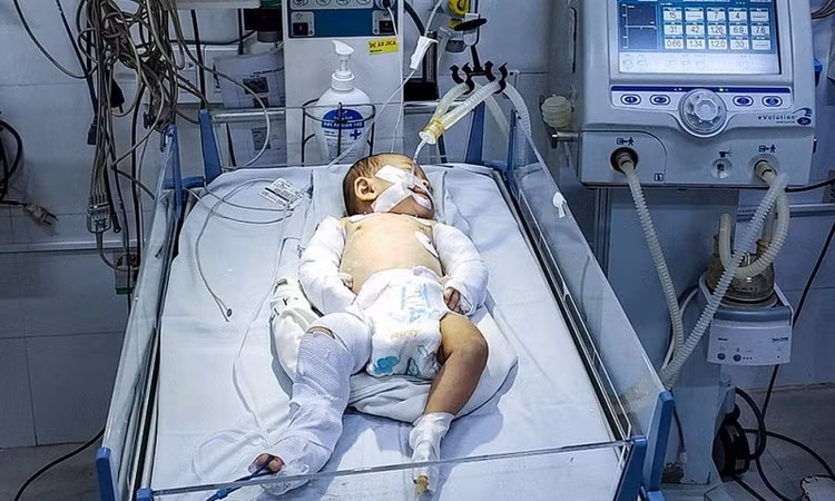 Bé gái đang được điều trị tại Bệnh viên Đa khoa Lâm Đồng.