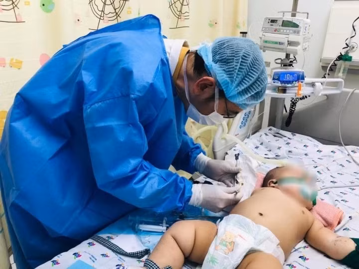 Bé trai 5 tháng tuổi bị cô đặc máu do sốc sốt xuất huyết nặng.