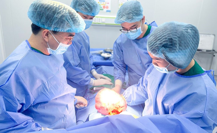Ekip phẫu thuật đã bóc tách thành công khối u buồng trứng khổng lồ. Ảnh BVCC