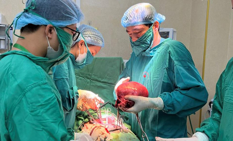 Các bác sĩ đang tiến hành phẫu thuật cắt khối U. Ảnh kinhtevadothi