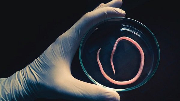 Bất ngờ phát hiện mắc 6 loại giun, sán từ những thói quen hàng ngày. Ảnh minh họa