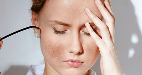 Dấu hiệu trên da &quot;tố cáo&quot; bạn đang căng thẳng quá mức. Ảnh minh họa