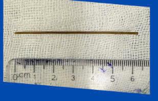 Hiểm họa khôn lường từ thói quen ngậm tăm tre ảnh 2