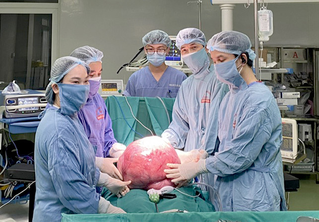 Hình ảnh khối u khổng lồ nặng 15 kg được lấy ra khỏi cơ thể người bệnh.