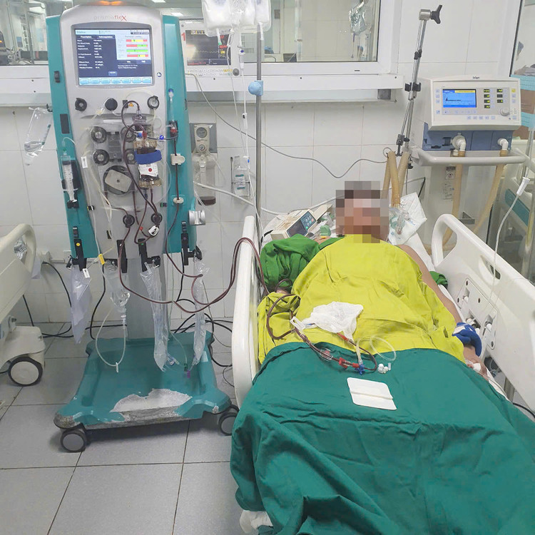 Hình ảnh người bệnh nặng được lọc máu khi cấp cứu tại khoa Hồi sức tích cực. Ảnh BVCC