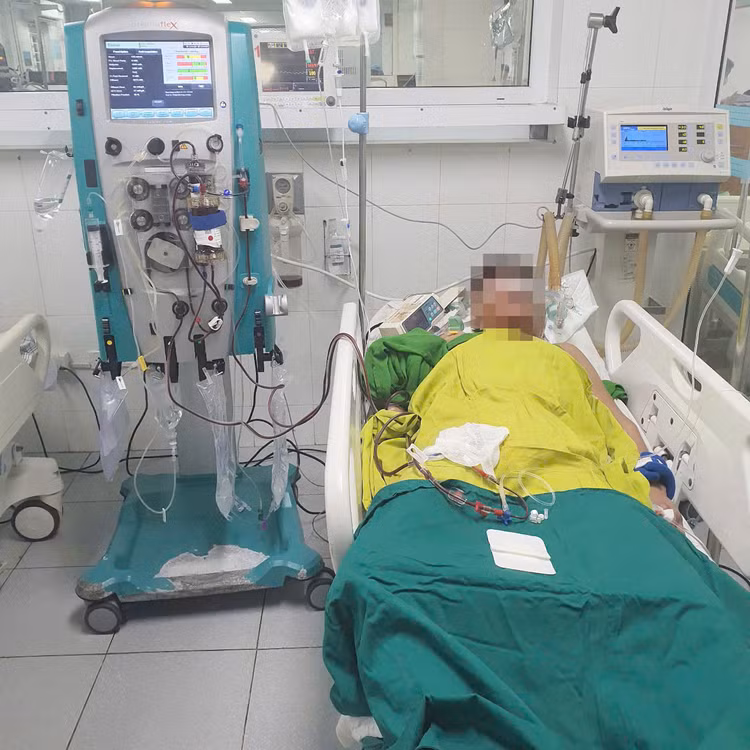 Hình ảnh người bệnh nặng được lọc máu khi cấp cứu tại khoa Hồi sức tích cực. Ảnh BVCC