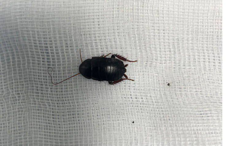 Bác sĩ loại bỏ con gián ra khỏi tai bệnh nhân H. Ảnh BVCC