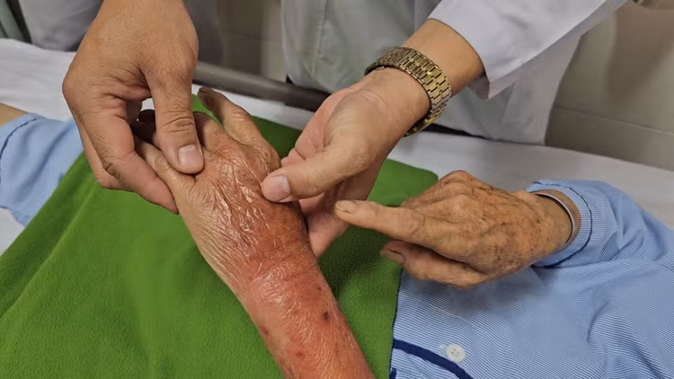 Bàn tay của bà M.T.L bị nhiễm trùng huyết sau khi bị kiến lửa cắn. Ảnh BVCC Bàn tay của bà M.T.L bị nhiễm trùng huyết sau khi bị kiến lửa cắn. Ảnh BVCC