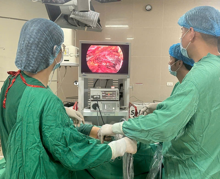 Ca phẫu thuật cắt thận cắt toàn bộ thận, niệu quản trái lấy bỏ toàn bộ tổ chức mỡ quanh thận, nạo vét hạch điều trị triệt căn cho bệnh nhân. Ảnh BVCC