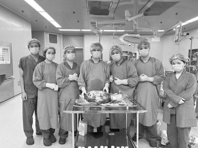 Các bác sĩ phẫu thuật thành công lấy khối u nặng 15kg ra khỏi cơ thể bệnh nhân - Ảnh: Báo Tiền Phong