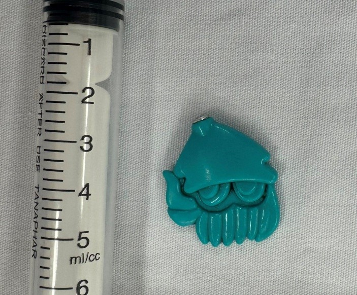 Con cá nhựa kích cỡ 2cm trong thực quản được gắp ra. Ảnh BVCC