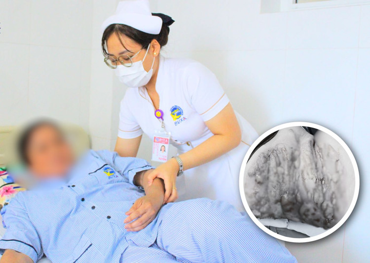 Bệnh nhân được theo dõi tại bệnh viện. Ảnh: BVCC