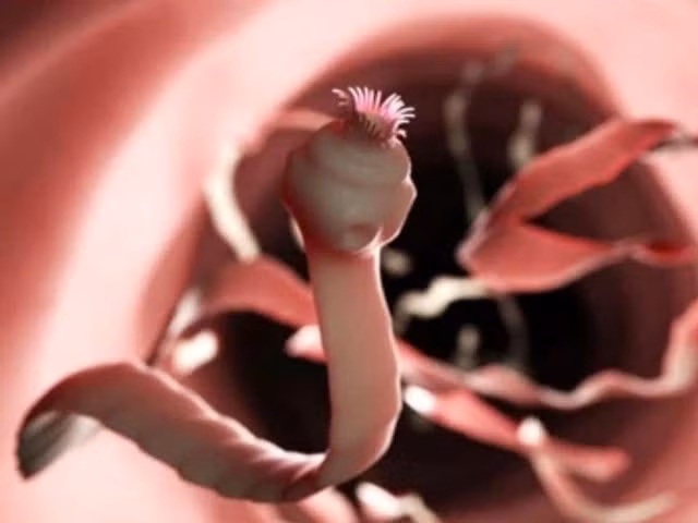 Thói quen ăn uống “mở đường” cho sán vào người, ít ai để ý.