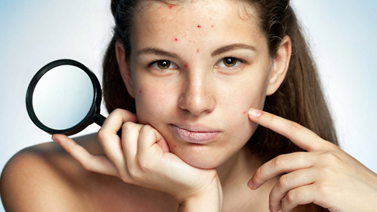 Vì sao da bạn mãi xấu chẳng đẹp lên dù đã chăm sóc rất kỳ công? Ảnh minh họa