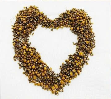 Hàng trăm viên sỏi lấp đầy túi mật người phụ nữ. Ảnh: Trung tâm Y tế huyện Cẩm Khê - Phú Thọ