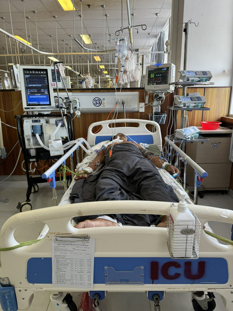 Bệnh uốn ván đang điều trị với nhiều máy móc xung quanh. Ảnh BVCC Bệnh uốn ván đang điều trị với nhiều máy móc xung quanh. Ảnh BVCC