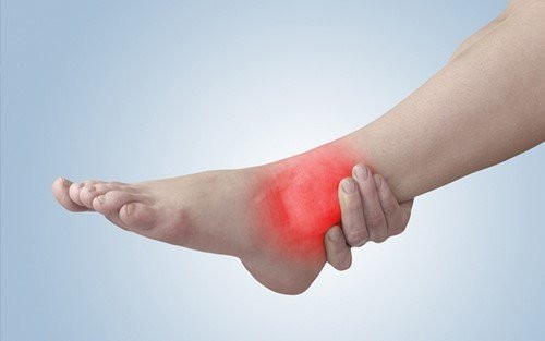 Sưng phù mắt cá chân dấu hiệu cảnh báo sức khỏe đang gặp vấn đề. Ảnh minh họa