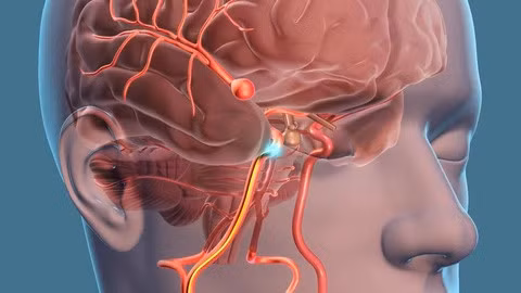 Phình mạch máu não - "Sát thủ thầm lặng tàn phá sức khỏe". Ảnh minh họa
