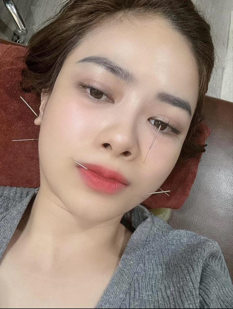 Dương Hoàng Yến chia sẻ hình ảnh điều trị trong bệnh viện. Ảnh: NVCC